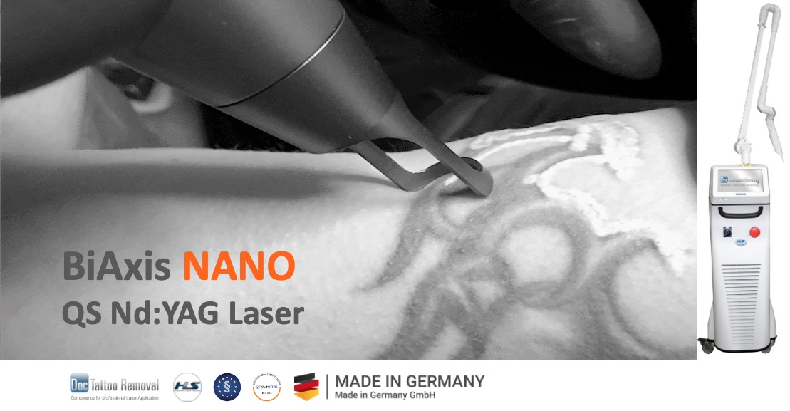 BiAxis NANO QS Nd:YAG Laser Tattooentfernung Doctare GmbH Copyright